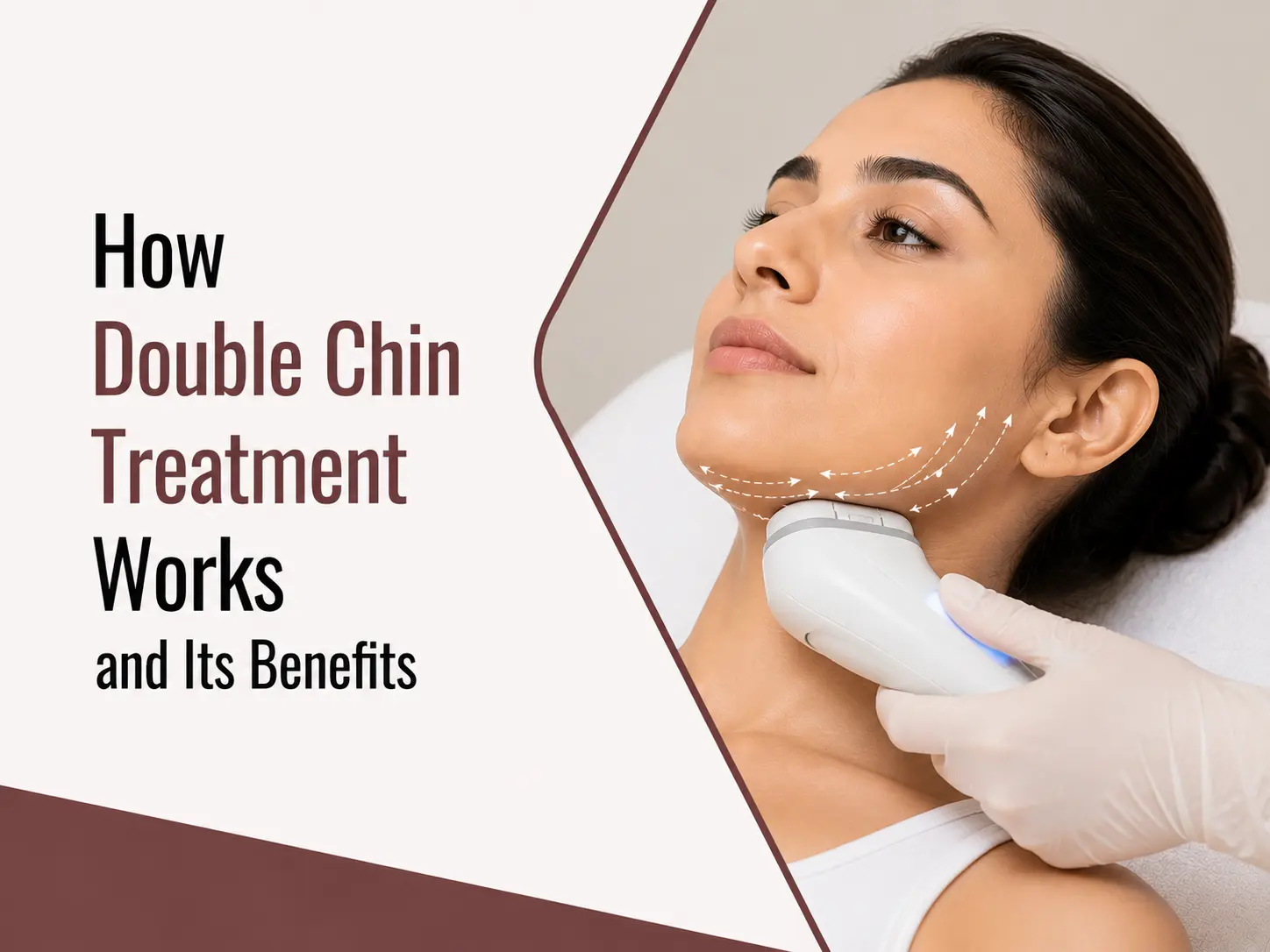 Double Chin Treatment Works