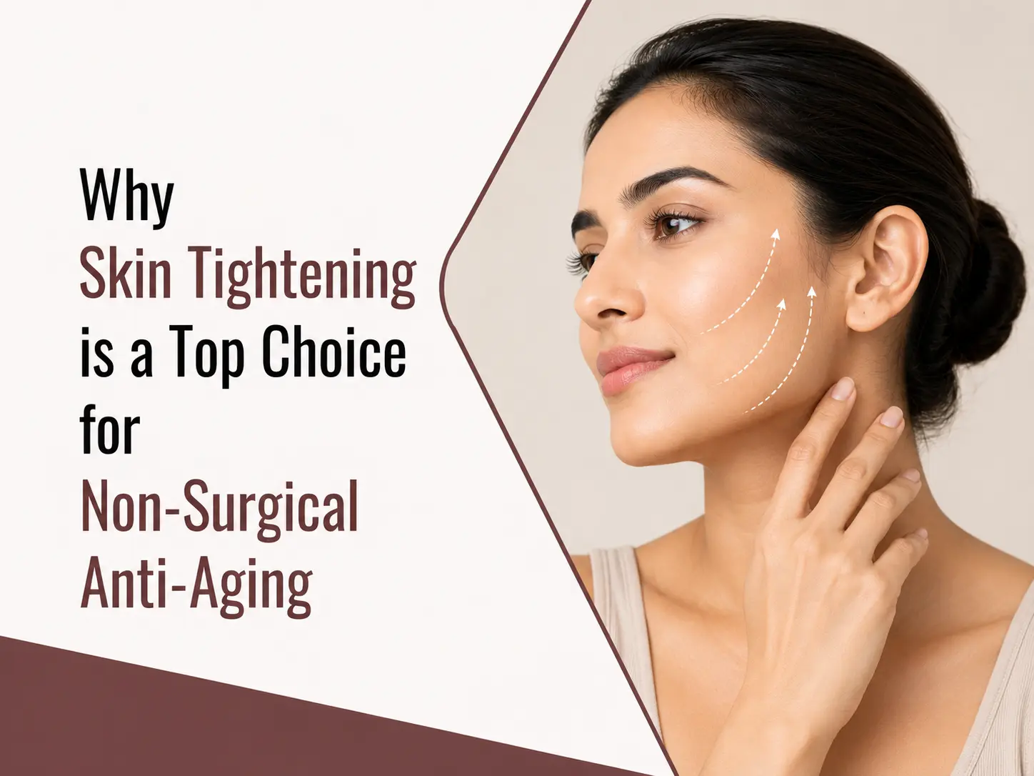 Why Skin Tightening is a Top Choice